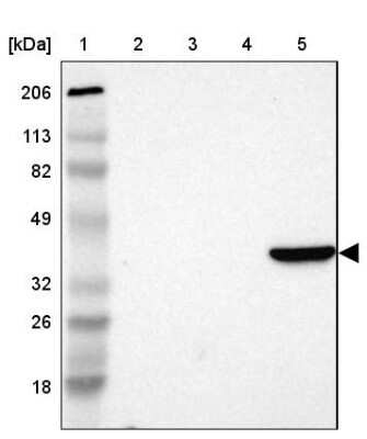 Western Blot: Aldolase B Antibody [NBP1-87494]