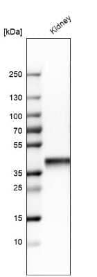 Western Blot: Aldolase B Antibody [NBP1-87494]