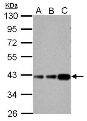 Western Blot: Aldolase B Antibody [NBP2-15344]