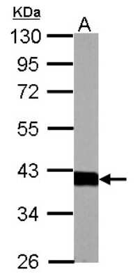 Western Blot: Aldolase B Antibody [NBP2-15344]