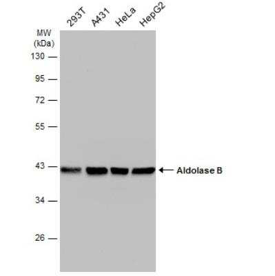Western Blot: Aldolase B Antibody [NBP2-15344]