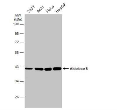 Western Blot: Aldolase B Antibody [NBP2-15344]