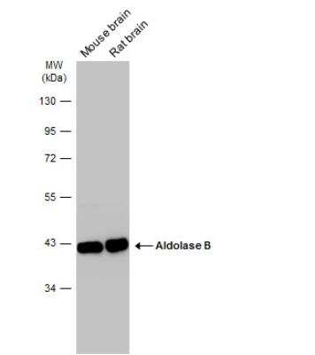 Western Blot: Aldolase B Antibody [NBP2-15344]