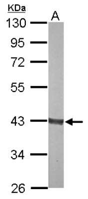 Western Blot: Aldolase B Antibody [NBP2-15345]