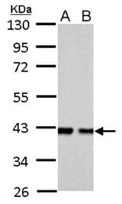 Western Blot: Aldolase B Antibody [NBP2-15345]