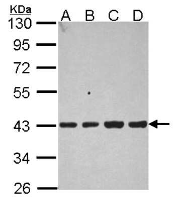Western Blot: Aldolase B Antibody [NBP2-15345]