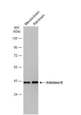 Western Blot: Aldolase B Antibody [NBP2-15345]