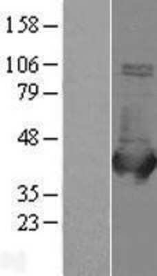 Western Blot: Aldolase B Overexpression Lysate [NBL1-07462]