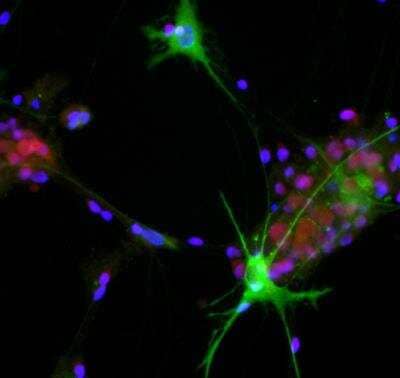 Immunocytochemistry/ Immunofluorescence: Aldolase C Antibody (1A1) [NBP2-25144]