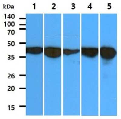 Western Blot: Aldolase C Antibody (2E11)BSA Free [NBP2-59408]