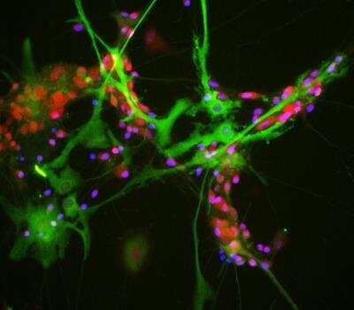 Immunocytochemistry/ Immunofluorescence: Aldolase C Antibody (4A9) [NBP2-25145]