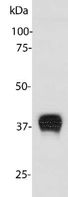 Western Blot: Aldolase C Antibody (E9) [NBP2-50056]