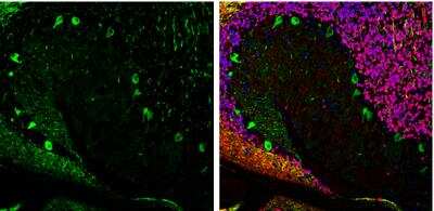 Immunohistochemistry-Frozen: Aldolase C Antibody [NBP2-15346]