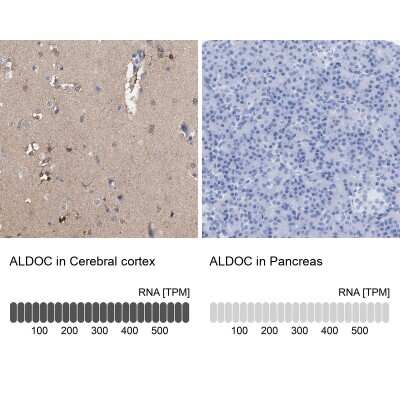 Immunohistochemistry-Paraffin: Aldolase C Antibody [NBP1-90954]