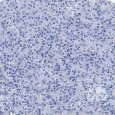 Immunohistochemistry-Paraffin: Aldolase C Antibody [NBP1-90954]