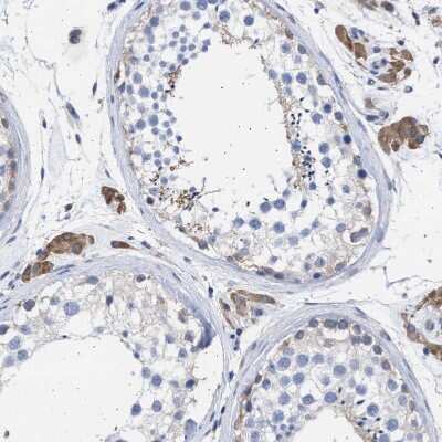 Immunohistochemistry-Paraffin: Aldolase C Antibody [NBP1-90954]