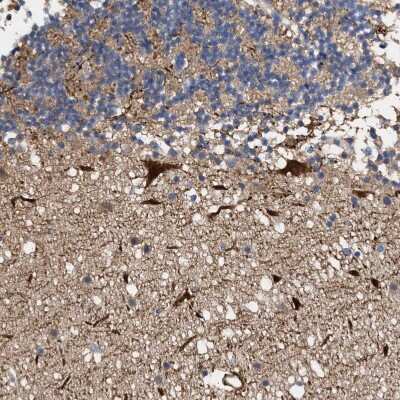Immunohistochemistry-Paraffin: Aldolase C Antibody [NBP1-90954]