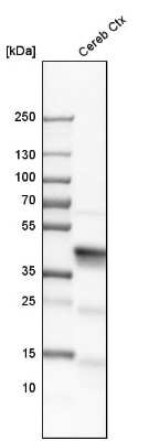 Western Blot: Aldolase C Antibody [NBP1-90954]