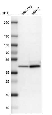 Western Blot: Aldolase C Antibody [NBP1-90954]