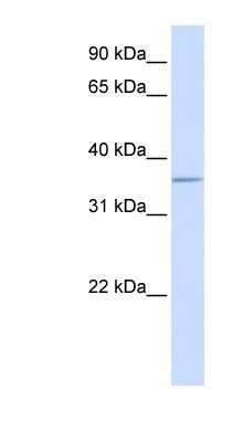 Western Blot: Aldolase C Antibody [NBP1-91323]