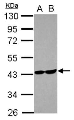 Western Blot: Aldolase C Antibody [NBP2-15346]