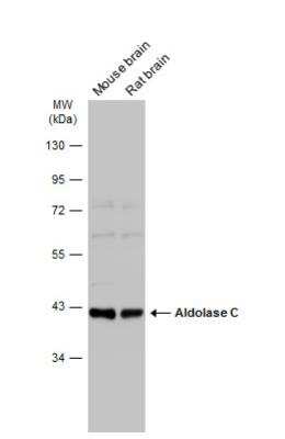 Western Blot: Aldolase C Antibody [NBP2-15346]