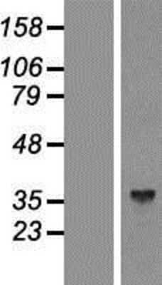 Western Blot: Aldolase C Overexpression Lysate [NBP2-07784]