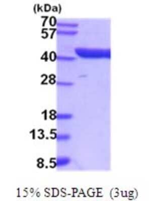 SDS-PAGE: Recombinant Mouse Aldolase C His Protein [NBP2-52078]