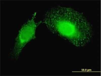 Immunocytochemistry/ Immunofluorescence: Alix Antibody (3C4) [H00010015-M01]