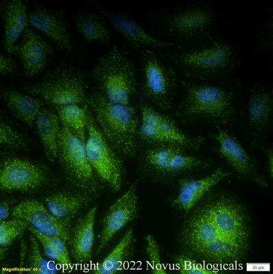 Immunocytochemistry/ Immunofluorescence: Alix Antibody - BSA Free [NBP1-49701]