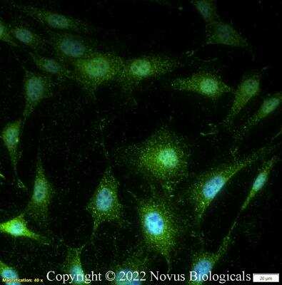 Immunocytochemistry/ Immunofluorescence: Alix Antibody - BSA Free [NBP1-49701]