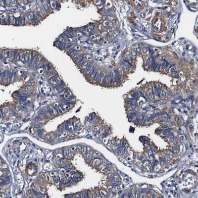 Immunohistochemistry-Paraffin: Alix Antibody [NBP1-90201]