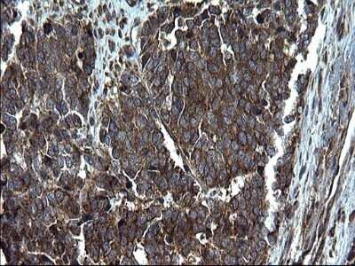 Immunohistochemistry: Alix Antibody (OTI1A4) - Azide and BSA Free [NBP2-71537]