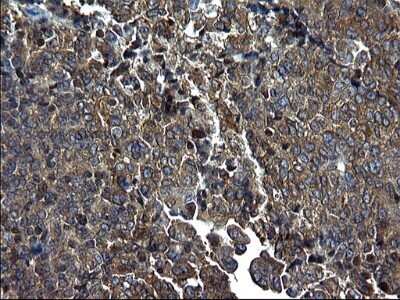Immunohistochemistry: Alix Antibody (OTI1A4) - Azide and BSA Free [NBP2-71537]
