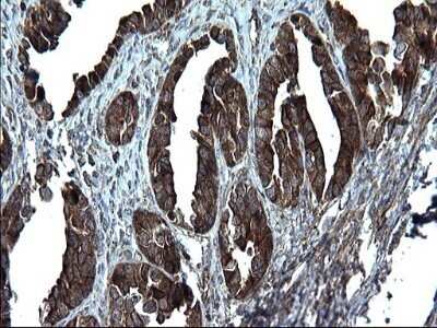 Immunohistochemistry: Alix Antibody (OTI1A4) - Azide and BSA Free [NBP2-71537]