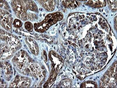 Immunohistochemistry: Alix Antibody (OTI1A4) - Azide and BSA Free [NBP2-71537]