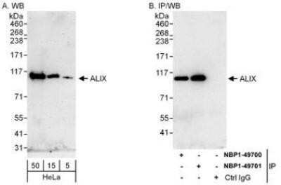 Western Blot: Alix AntibodyBSA Free [NBP1-49701]