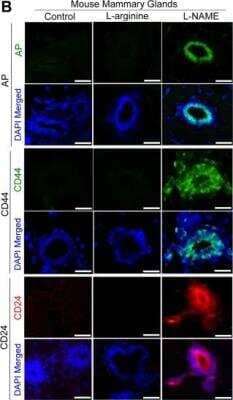 Immunocytochemistry/ Immunofluorescence: Alkaline Phosphatase, Tissue Non-Specific Antibody [NBP1-32948]