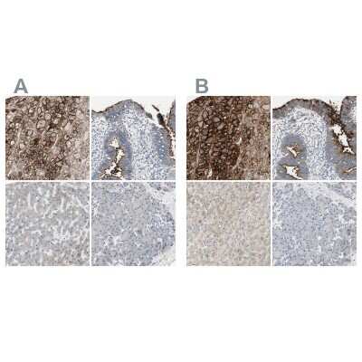 Immunohistochemistry-Paraffin: Alkaline Phosphatase, Tissue Non-Specific Antibody [NBP1-91659]