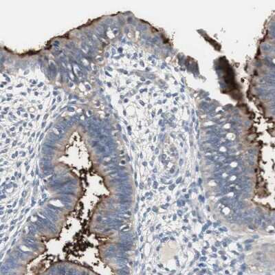 Immunohistochemistry-Paraffin: Alkaline Phosphatase, Tissue Non-Specific Antibody [NBP1-91659]