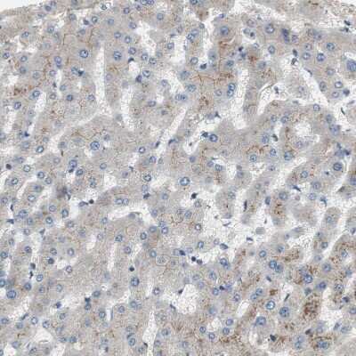 Immunohistochemistry-Paraffin: Alkaline Phosphatase, Tissue Non-Specific Antibody [NBP1-91659]