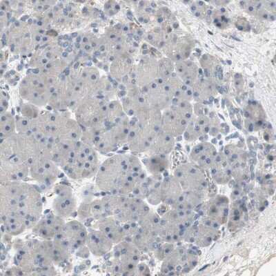 Immunohistochemistry-Paraffin: Alkaline Phosphatase, Tissue Non-Specific Antibody [NBP1-91659]