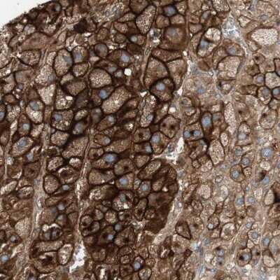 Immunohistochemistry-Paraffin: Alkaline Phosphatase, Tissue Non-Specific Antibody [NBP1-91660]