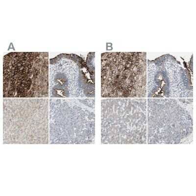 Immunohistochemistry-Paraffin: Alkaline Phosphatase, Tissue Non-Specific Antibody [NBP1-91660]