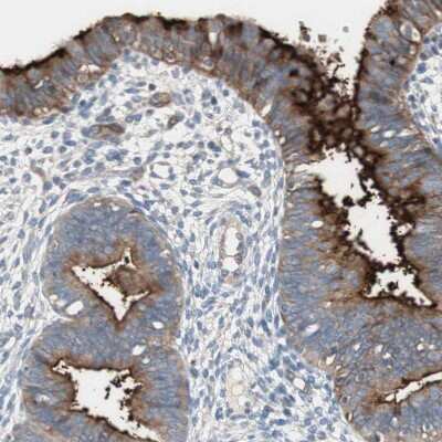 Immunohistochemistry-Paraffin: Alkaline Phosphatase, Tissue Non-Specific Antibody [NBP1-91660]