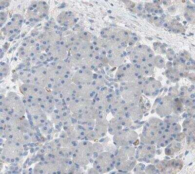 Immunohistochemistry-Paraffin: Alkaline Phosphatase, Tissue Non-Specific Antibody [NBP1-91660]
