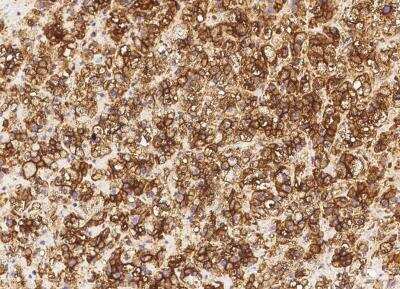 Immunohistochemistry-Paraffin: Alkaline Phosphatase/ALPL Antibody (034) [NBP2-89223]