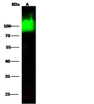 Western Blot: Alkaline Phosphatase/ALPL Antibody (071) [NBP2-89224]