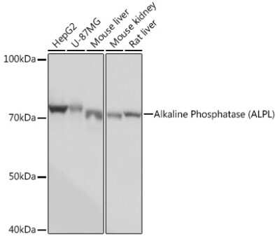 Western Blot: Alkaline Phosphatase/ALPL Antibody (10B1M5) [NBP3-15273]