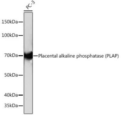 Western Blot: Alkaline Phosphatase/ALPP/ALPI Antibody (10Q2X7) [NBP3-16373]